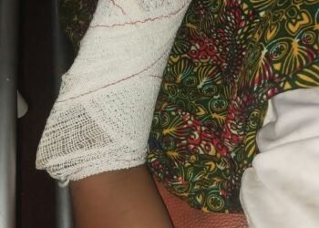 Accident de circulation: L&rsquo;administrateur général de Walpmedia.info victime.