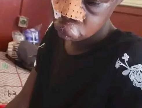 Kindia : Quand le plaisir se transforme en douleur.