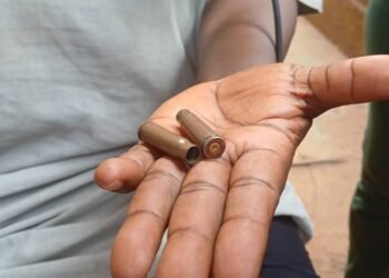 Gomboya : Le chef de secteur blessé lors d’affrontements entre habitants et forces de l’ordre témoigne.