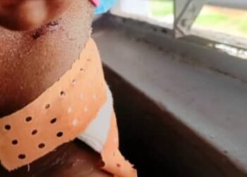 Labé : Mamadou Saliou Dieng grièvement blessé par balle au cou. 