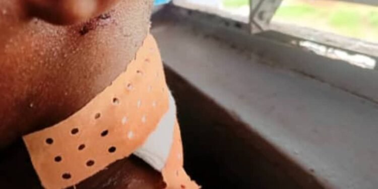 Labé : Mamadou Saliou Dieng grièvement blessé par balle au cou. 