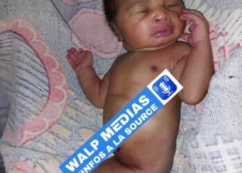 Faranah : Naissance d’un nouveau-né présentant une malformation rare à Bontala   