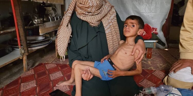 Conflit Israël-Hamas : La famine fait plus de 280 victimes à Gaza.   