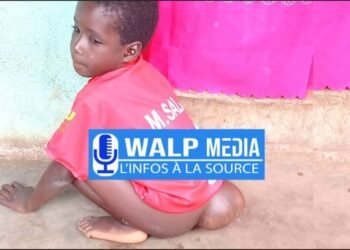 Kankan : À 9 ans, le jeune Adama Keïta lutte depuis sa naissance contre une grave malformation congénitale   