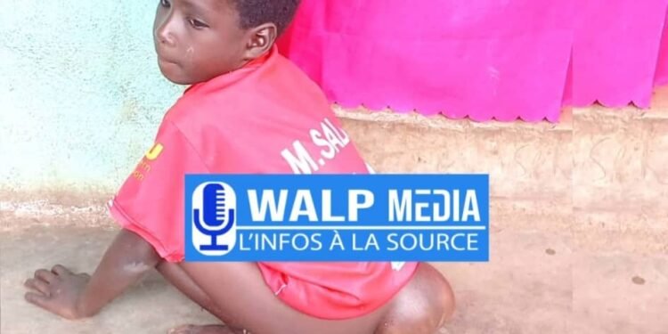 Kankan : À 9 ans, le jeune Adama Keïta lutte depuis sa naissance contre une grave malformation congénitale   