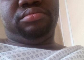 Guinée : SOS pour Joe Festi, pilier du Circus Baobab oublié de tous.    