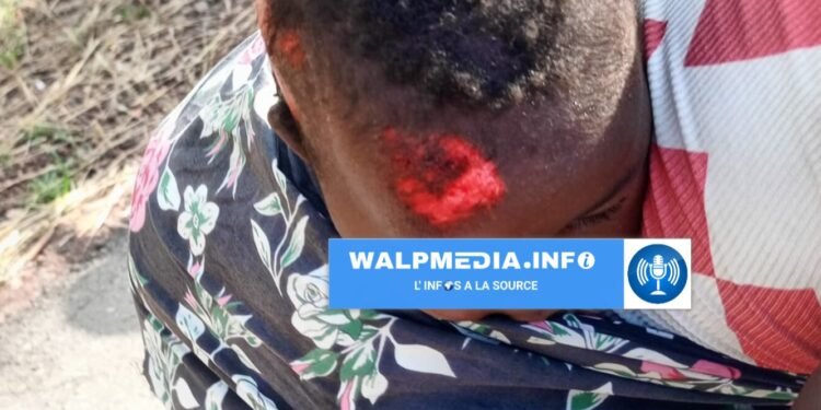 Kankan : cinq blessés graves dans un accident de la circulation à Balandou.