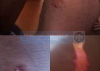 Guinée-Côte d’Ivoire : affrontements autour de la mare Dalagbeba, plusieurs blessés enregistrés.