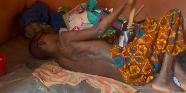 SOS : Après 26 ans de paralysie, Mamadou Baïlo Bah lance un appel à la solidarité