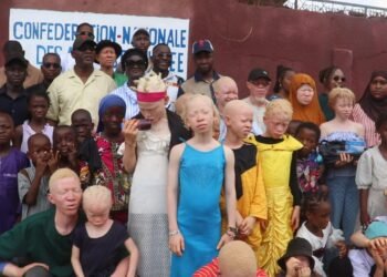 Sangoyah : Des enfants atteints d&rsquo;albinisme reçoivent des kits scolaires, un geste qui redonne espoir   