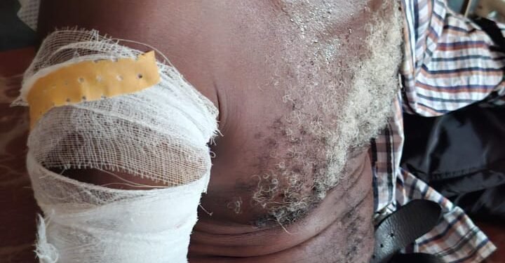 Siguiri : Bains de sang entre deux hameaux, 6 personnes touchées par balle